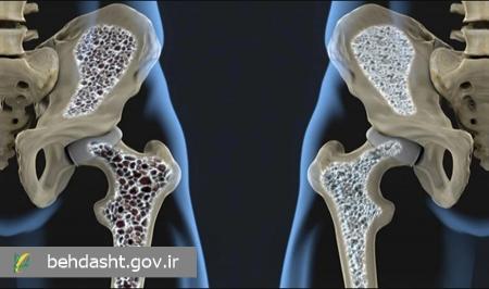 نقش تمرینات هدفمند در حفظ سلامت استخوان‌ها و پیشگیری از پوکی استخوان